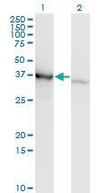 Anti-PCBP1 Mouse Monoclonal Antibody [clone: 1G2]