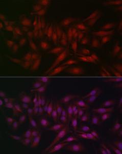 Anti-STAT5 antibody