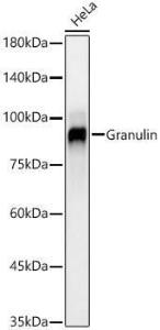 Western blot analysis of HeLa, using Anti-Granulin Antibody [ARC59451] (A309379) at 1:2,000 dilution. The secondary Antibody was Goat Anti-Rabbit IgG H&L Antibody (HRP) at 1:10000 dilution. Lysates/proteins were present at 25 µg per lane