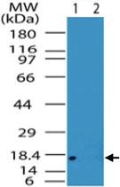 Anti-ACP1 Rabbit Polyclonal Antibody