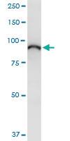 Anti-ELAC2 Rabbit Polyclonal Antibody