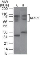 Anti-NFATC1 Rabbit Polyclonal Antibody