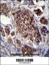 Anti-FRAT2 Rabbit Polyclonal Antibody (Biotin)