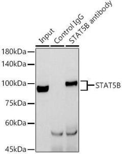 Anti-STAT5 antibody