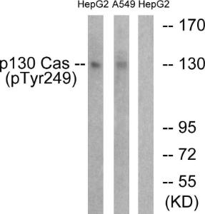 Western blot analysis of lysates from HepG2 cells treated with EGF 200 ng/ml 30' and A549 cells treated with PMA 125 ng/ml 30' using Anti-p130 Cas (phospho Tyr249) Antibody. The right hand lane represents a negative control, where the Antibody is blocked by the immunising peptide