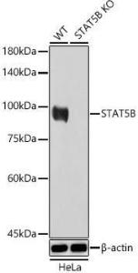 Anti-STAT5 antibody