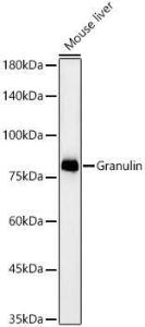 Western blot analysis of Mouse liver, using Anti-Granulin Antibody [ARC59451] (A309379) at 1:2,000 dilution. The secondary Antibody was Goat Anti-Rabbit IgG H&L Antibody (HRP) at 1:10000 dilution. Lysates/proteins were present at 25 µg per lane