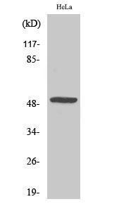 Western blot analysis of Jurkat cells using Anti-MYLIP Antibody