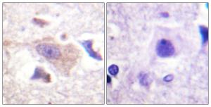 Anti-GRB10 antibody