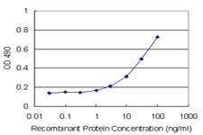 Anti-ARHGDIB Polyclonal Antibody Pair