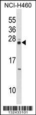 Anti-MOB4 Rabbit Polyclonal Antibody