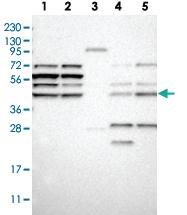 Anti-PISD Rabbit Polyclonal Antibody