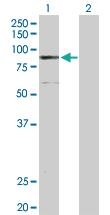 Anti-ELAC2 Rabbit Polyclonal Antibody