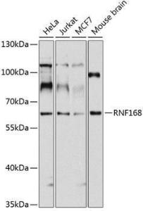 Anti-RNF168 Rabbit Polyclonal Antibody