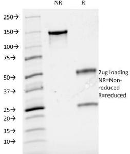 SDS-PAGE analysis of Anti-Cyclin A2 Antibody [CCNA2/2333] under non-reduced and reduced conditions; showing intact IgG and intact heavy and light chains, respectively. SDS-PAGE analysis confirms the integrity and purity of the Antibody