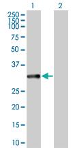 Anti-MAPRE1 Mouse Polyclonal Antibody