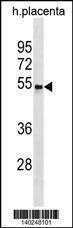 Anti-CCKAR Rabbit Polyclonal Antibody (HRP (Horseradish Peroxidase))