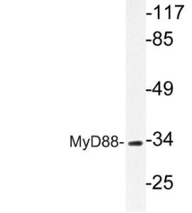 Western blot analysis of lysate from COLO cells using Anti-MyD88 Antibody