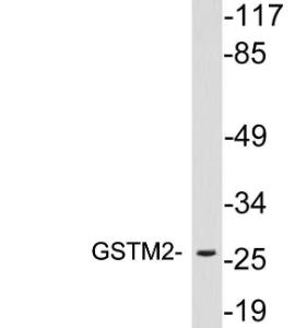 Western blot analysis of lysates from 293 cells using Anti-GSTM2 Antibody