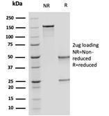 SDS-PAGE analysis of Anti-OVOL2 Antibody [PCRP-OVOL2-2A1] under non-reduced and reduced conditions; showing intact IgG and intact heavy and light chains, respectively. SDS-PAGE analysis confirms the integrity and purity of the antibody