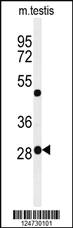 Anti-POLR3H Rabbit Polyclonal Antibody