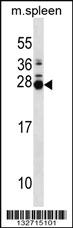 Anti-MOB3B Rabbit Polyclonal Antibody