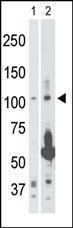 Anti-MAP3K14 Rabbit Polyclonal Antibody (AP (Alkaline Phosphatase))