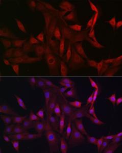 Anti-STAT5 antibody