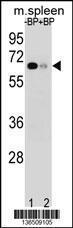 Anti-ASB3 Rabbit Polyclonal Antibody (AP (Alkaline Phosphatase))