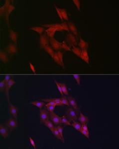 Anti-STAT5 antibody