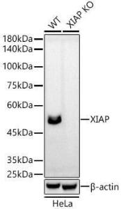 Anti-XIAP Rabbit Monoclonal Antibody [clone: ARC51953]