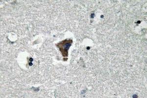 Immunohistochemical analysis of paraffin-embedded human brain tissue using Anti-MyD88 Antibody