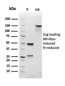 SDS-PAGE analysis of Anti-RAC1 Antibody [CPTC-RAC1-1] under non-reduced and reduced conditions; showing intact IgG and intact heavy and light chains, respectively. SDS-PAGE analysis confirms the integrity and purity of the antibody