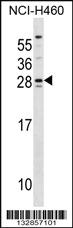 Anti-SH3BGR Rabbit Polyclonal Antibody