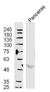 Mouse Pancreas lysates probed with  Polyclonal Antibody, unconjugated (bs-11553R) at 1:300 overnight at 4°C followed by a conjugated secondary antibody at 1:10000 for 60 minutes at 37°C.