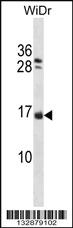 Anti-NHLH1 Rabbit Polyclonal Antibody