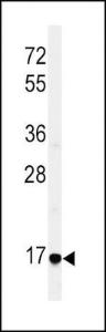 Anti-EREG Rabbit Polyclonal Antibody (HRP (Horseradish Peroxidase))