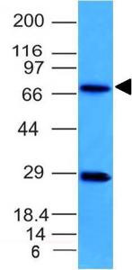 Anti-TOP1MT antibody