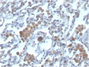 Immunohistochemical analysis of formalin-fixed, paraffin-embedded human lung using Anti-RAC1 Antibody [CPTC-RAC1-1]