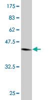 Anti-NUDT4 Mouse Monoclonal Antibody [clone: 2F2]