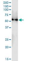 Anti-TUBB4Q Polyclonal Antibody Pair