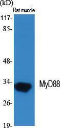 Western blot analysis of various cells using Anti-MyD88 Antibody