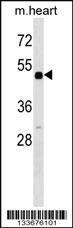 Anti-RARB Rabbit Polyclonal Antibody