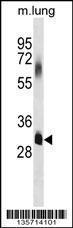 Anti-ELOVL7 Rabbit Polyclonal Antibody (FITC (Fluorescein Isothiocyanate))