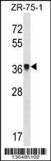 Anti-FRG1 Rabbit Polyclonal Antibody (AP (Alkaline Phosphatase))