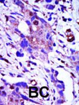 Anti-PLK1 Rabbit Polyclonal Antibody (AP (Alkaline Phosphatase))