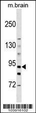 Anti-Hexokinase 3 Rabbit Polyclonal Antibody (AP (Alkaline Phosphatase))