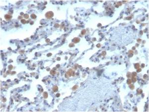 Immunohistochemical analysis of formalin-fixed, paraffin-embedded human lung using Anti-RAC1 Antibody [CPTC-RAC1-1]