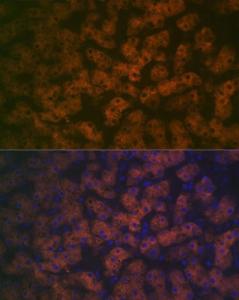 Anti-FMO3 antibody