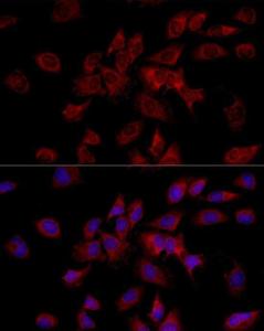 Anti-HADHA Rabbit Polyclonal Antibody